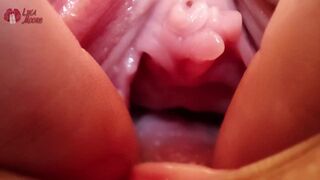 Extreme Pussy Nahaufnahme mit wilder Dilation