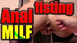 Sie können eine dreckige, anal milf fists selbst kostenlos